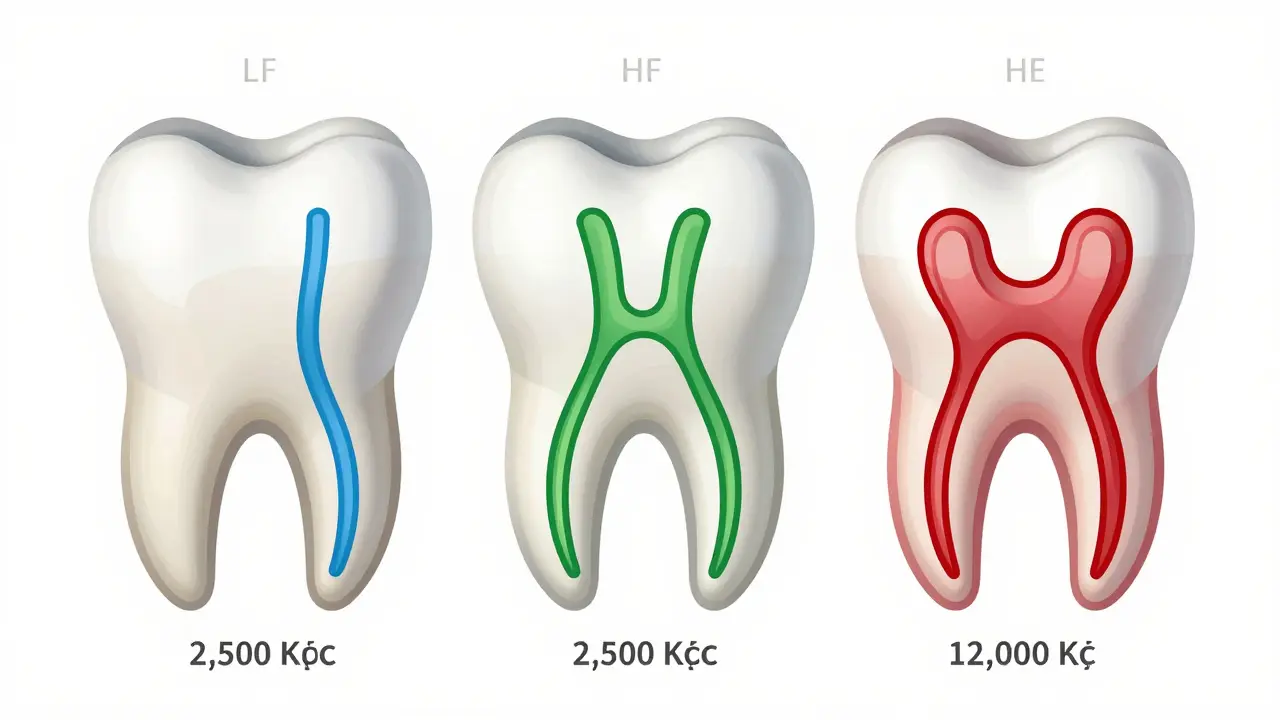 Three molars with color-coded root canals showing increasing complexity and price range.