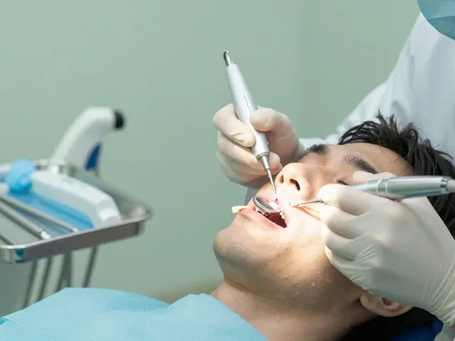 Proč je kyretáž zubů důležitá pro vaše zdraví: vše, co potřebujete vědět