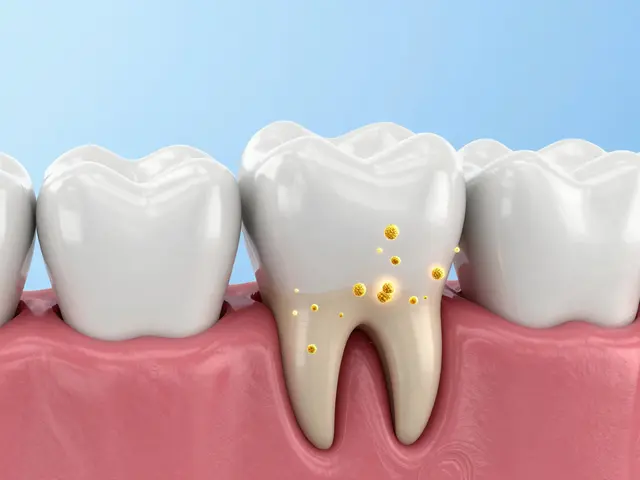 Co znamená váček pod zubem a jak řešit mezizubní kaz