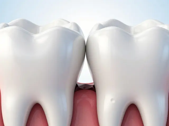Jak zastavit mezizubní kaz dříve, než uvidíte dentista