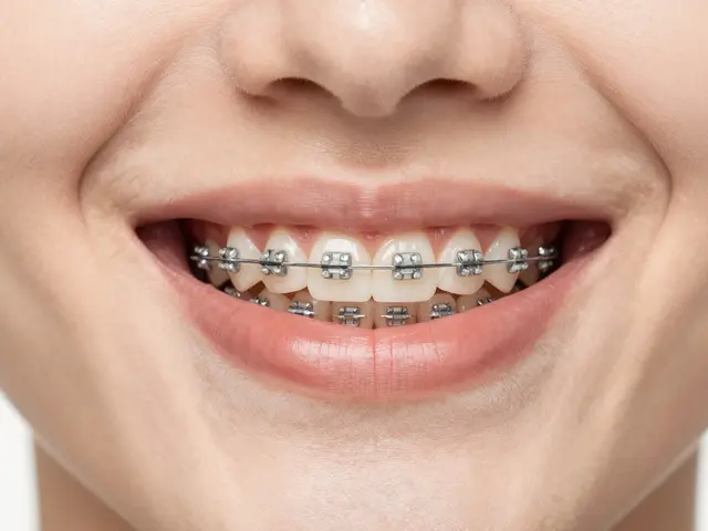 Keramické rovnátka: Estetická alternativa, která opravdu funguje